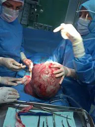 مار دختر 34  ساله  اهل و ساکن ارومیه که با شکایت درد